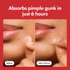 Custom Shape Hydrocolloid Blemishes Acne Pimple Patch for Covering Zits